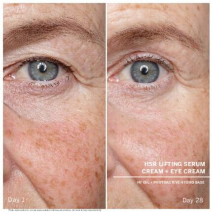 hsr serum before after