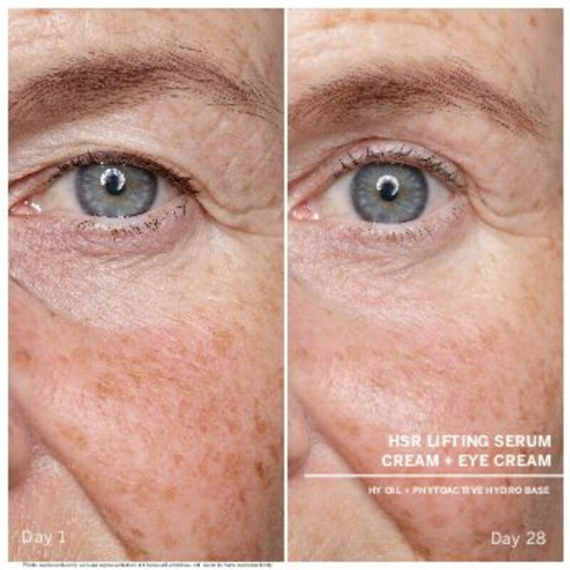 hsr serum before after