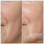 hsr serum before after