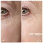 hsr serum before after