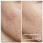 active purifier before after