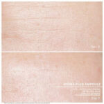 Hydra Plus before after