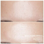 Multi Vitamin before after