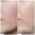 sos calming before after