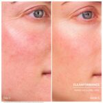 herbal balancing toner